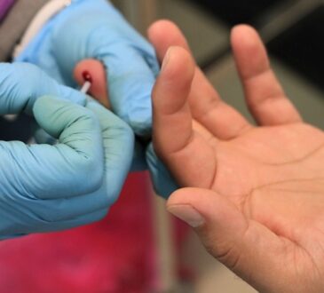 Servicios de Salud ofrece permanentemente prueba gratuita de detección de VIH