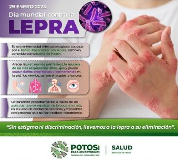 Programa de micobacteriosis trabaja en prevención y detección de lepra.
